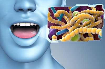 The image shows a 3D rendering of a human head with an open mouth, superimposed on a background that includes a close-up of microscopic bacteria.