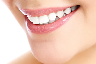 The image shows a close-up of a person s smiling face with visible teeth, highlighting dental hygiene or cosmetic dentistry services.