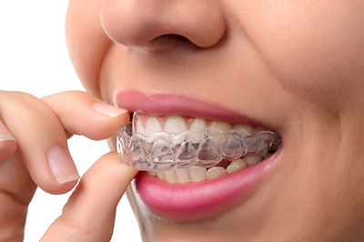 The image shows a person s hand holding an object that appears to be a dental appliance, such as a retainer or mouthguard, with a focus on the teeth alignment aspect of the device.