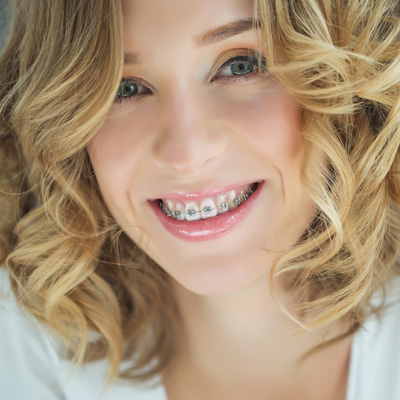 The image shows a smiling woman with braces, wearing a white top, posing for a portrait with her hair styled.