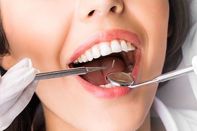 An advertisement featuring a woman with open mouth, receiving dental care from a professional using specialized equipment.