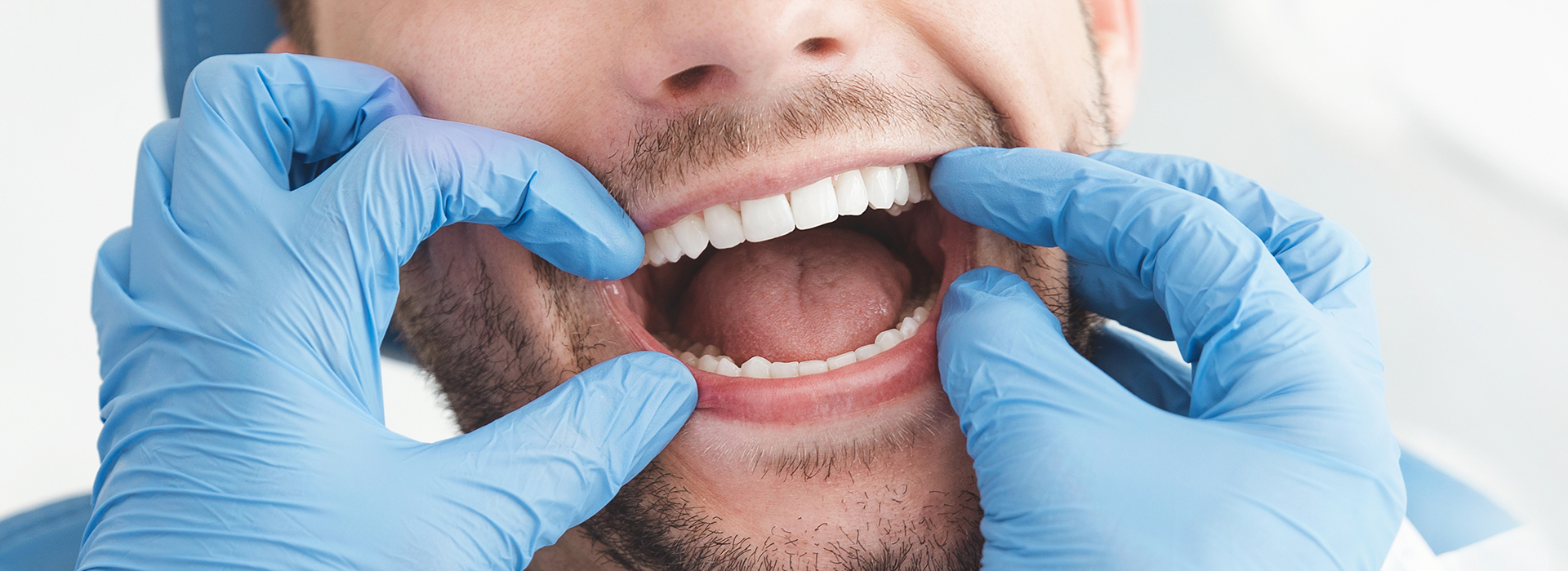 A man wearing a surgical mask and gloves holds his mouth open with his hands, displaying his teeth.